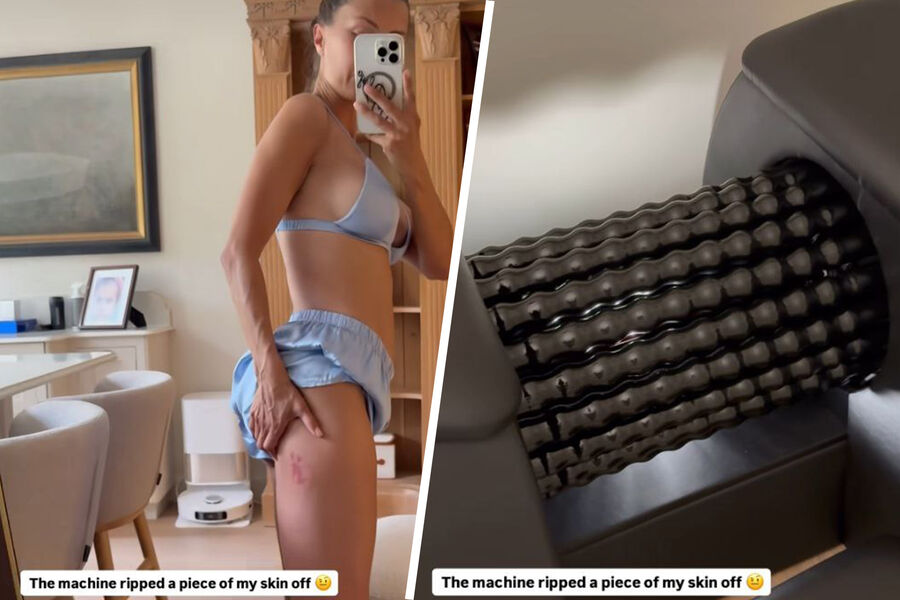 Блогер Боня рассказала, что ей оторвало кусок кожи на массажере от целлюлита