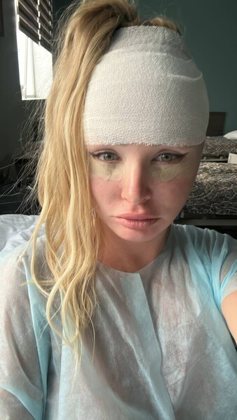 Телеведущая Дарья Пынзарь сделала пластическую операцию