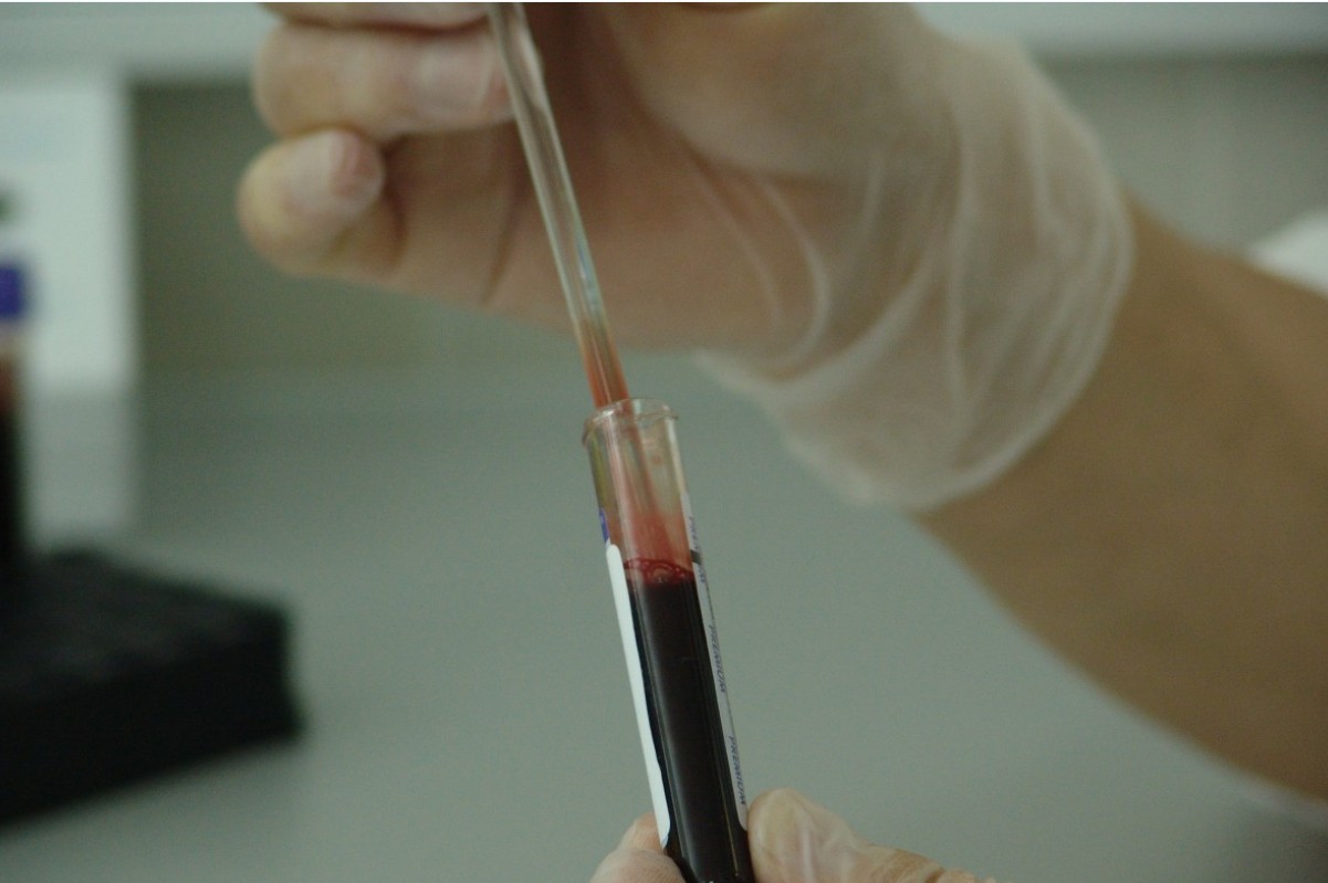 Эльвира Хачирова назвала рыбу и овощи продуктами для защиты сердца